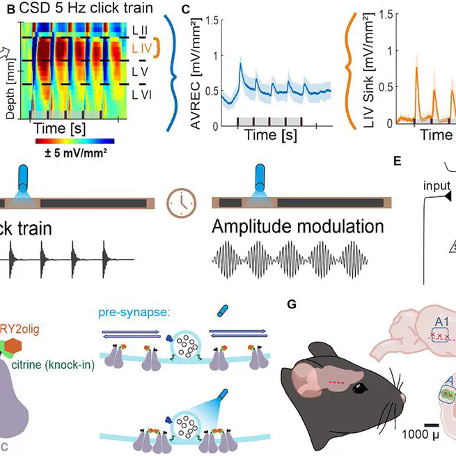 Inhibiting presynaptic calcium channel motility in the auditory cortex suppresses synchronized input processing