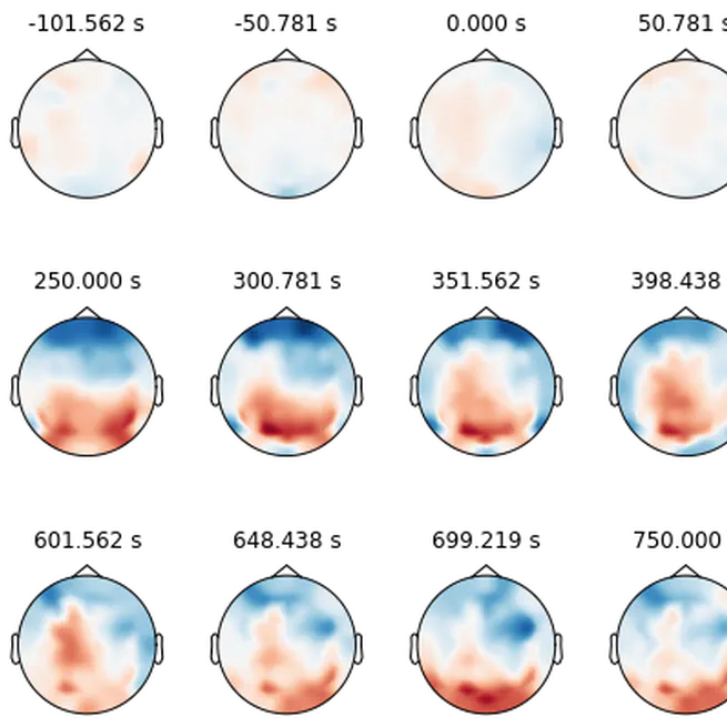 Intro to EEG Data Analysis