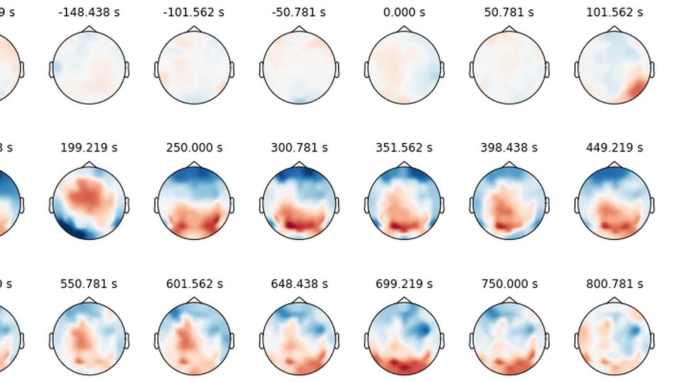 Intro to EEG Data Analysis